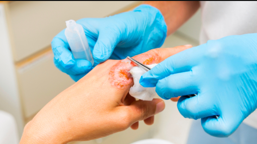 Plastic Surgery & Burn Unit