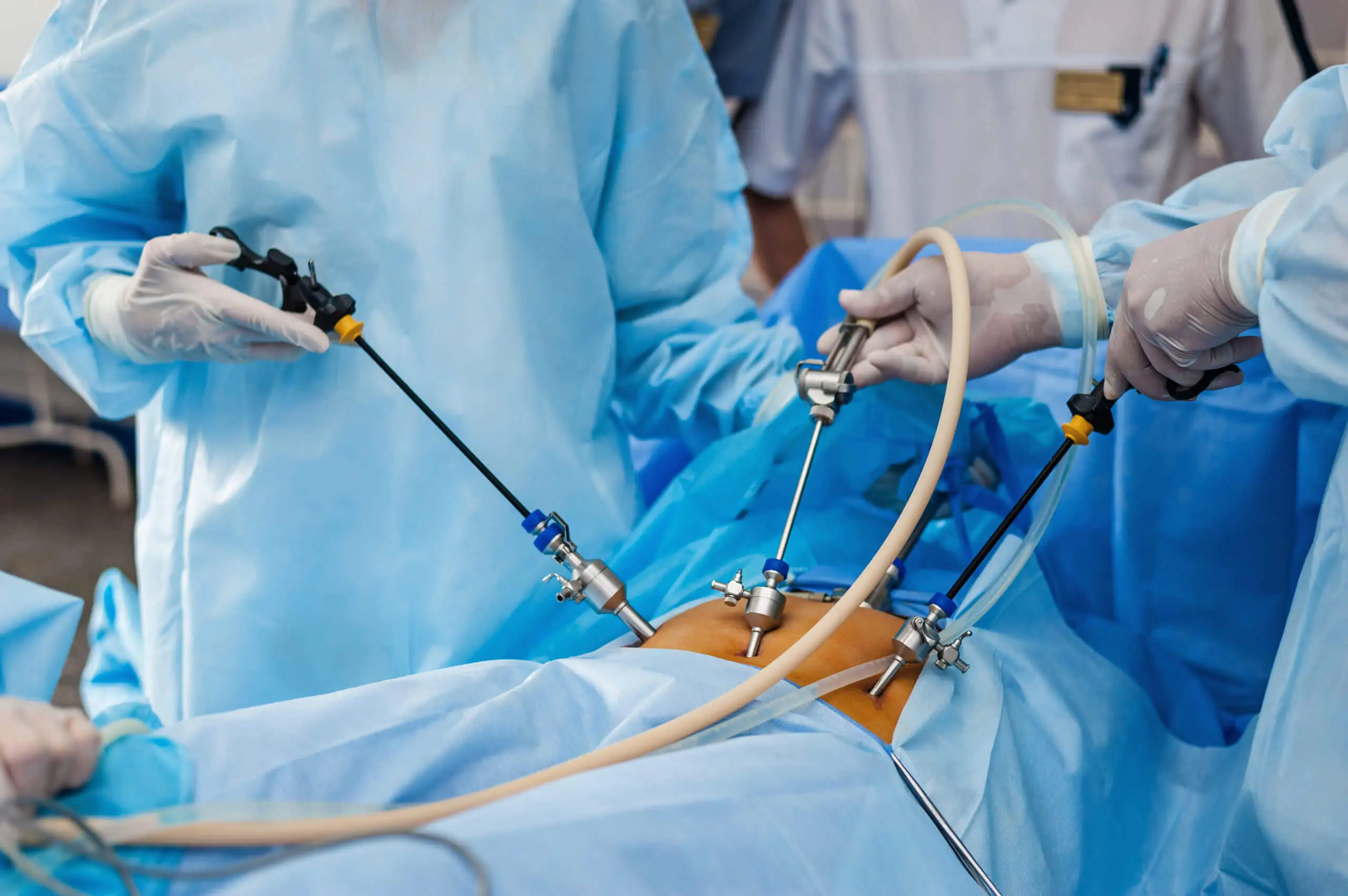 Endoscopic